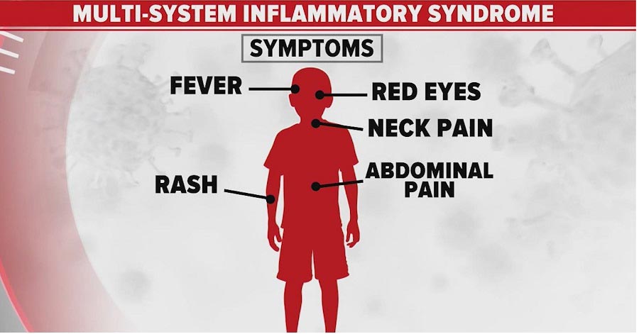 Multisystem Inflammatory Syndrome in Children