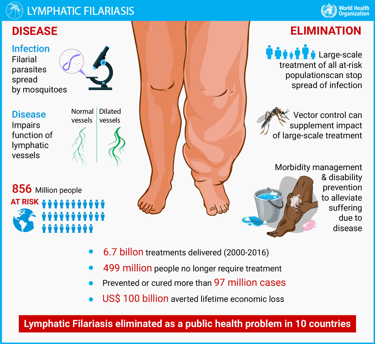 Lymphatic Filariasis